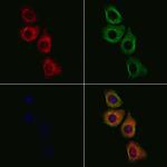 MATK Antibody in Immunocytochemistry (ICC/IF)