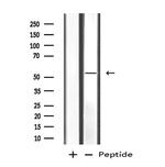 MATK Antibody in Western Blot (WB)