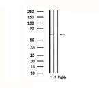 MATK Antibody in Western Blot (WB)