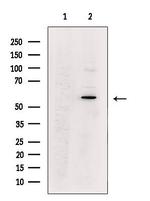 MATK Antibody in Western Blot (WB)