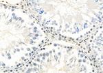 Opsin 3 Antibody in Immunohistochemistry (Paraffin) (IHC (P))