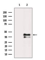 AGTR1 Antibody in Western Blot (WB)