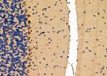 NPY1R Antibody in Immunohistochemistry (Paraffin) (IHC (P))