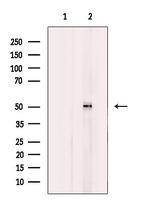 NPY5R Antibody in Western Blot (WB)