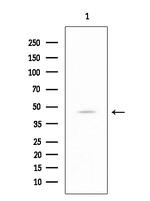 SCTR Antibody in Western Blot (WB)