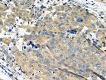 RAP1A Antibody in Immunohistochemistry (Paraffin) (IHC (P))