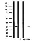 Endothelin 3 Antibody in Western Blot (WB)