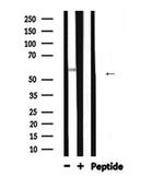 ALPL Antibody in Western Blot (WB)