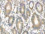 C19orf10 Antibody in Immunohistochemistry (Paraffin) (IHC (P))