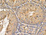 C19orf10 Antibody in Immunohistochemistry (Paraffin) (IHC (P))