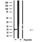 C19orf10 Antibody in Western Blot (WB)