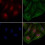 TRADD Antibody in Immunocytochemistry (ICC/IF)