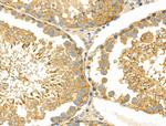 KCNE1 Antibody in Immunohistochemistry (Paraffin) (IHC (P))