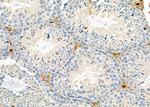 CGA Antibody in Immunohistochemistry (Paraffin) (IHC (P))