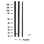 CGA Antibody in Western Blot (WB)