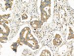 CYP1B1 Antibody in Immunohistochemistry (Paraffin) (IHC (P))