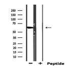 CYP1B1 Antibody in Western Blot (WB)