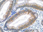 ABO Antibody in Immunohistochemistry (Paraffin) (IHC (P))