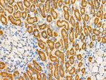 ABO Antibody in Immunohistochemistry (Paraffin) (IHC (P))