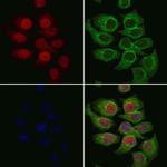 BTRC Antibody in Immunocytochemistry (ICC/IF)