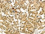 BTRC Antibody in Immunohistochemistry (Paraffin) (IHC (P))