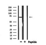 BTRC Antibody in Western Blot (WB)