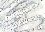 Complement Factor B Antibody in Immunohistochemistry (Paraffin) (IHC (P))