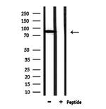 Complement Factor B Antibody in Western Blot (WB)