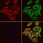 GABRA2 Antibody in Immunocytochemistry (ICC/IF)