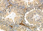 HSD3B2 Antibody in Immunohistochemistry (Paraffin) (IHC (P))