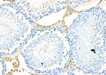 HSD3B2 Antibody in Immunohistochemistry (Paraffin) (IHC (P))