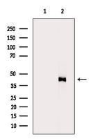 HSD3B2 Antibody in Western Blot (WB)