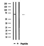 PTBP1 Antibody in Western Blot (WB)