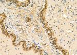 PPP2R4 Antibody in Immunohistochemistry (Paraffin) (IHC (P))