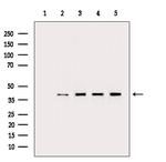 PPP2R4 Antibody in Western Blot (WB)