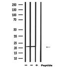 PRDX2 Antibody in Western Blot (WB)