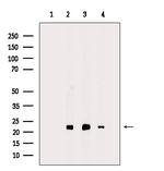 PRDX2 Antibody in Western Blot (WB)