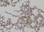 DLC1 Antibody in Immunohistochemistry (Paraffin) (IHC (P))