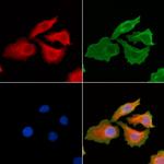 PRL3 Antibody in Immunocytochemistry (ICC/IF)