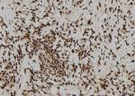 Zyxin Antibody in Immunohistochemistry (Paraffin) (IHC (P))