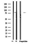 Zyxin Antibody in Western Blot (WB)