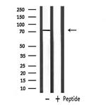 Zyxin Antibody in Western Blot (WB)