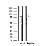 Zyxin Antibody in Western Blot (WB)