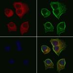 P2Y6 Antibody in Immunocytochemistry (ICC/IF)