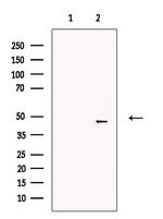 VEGFC Antibody in Western Blot (WB)