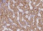 CPT2 Antibody in Immunohistochemistry (Paraffin) (IHC (P))