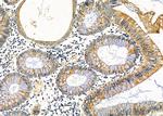 CPT2 Antibody in Immunohistochemistry (Paraffin) (IHC (P))