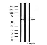 CHRM5 Antibody in Western Blot (WB)