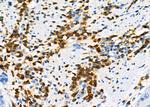 NQO2 Antibody in Immunohistochemistry (Paraffin) (IHC (P))