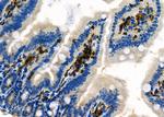 NQO2 Antibody in Immunohistochemistry (Paraffin) (IHC (P))